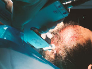 PRP Hair Treatment Surgery