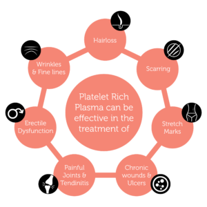 Platelet Rich Plasma Treatment Areas 01