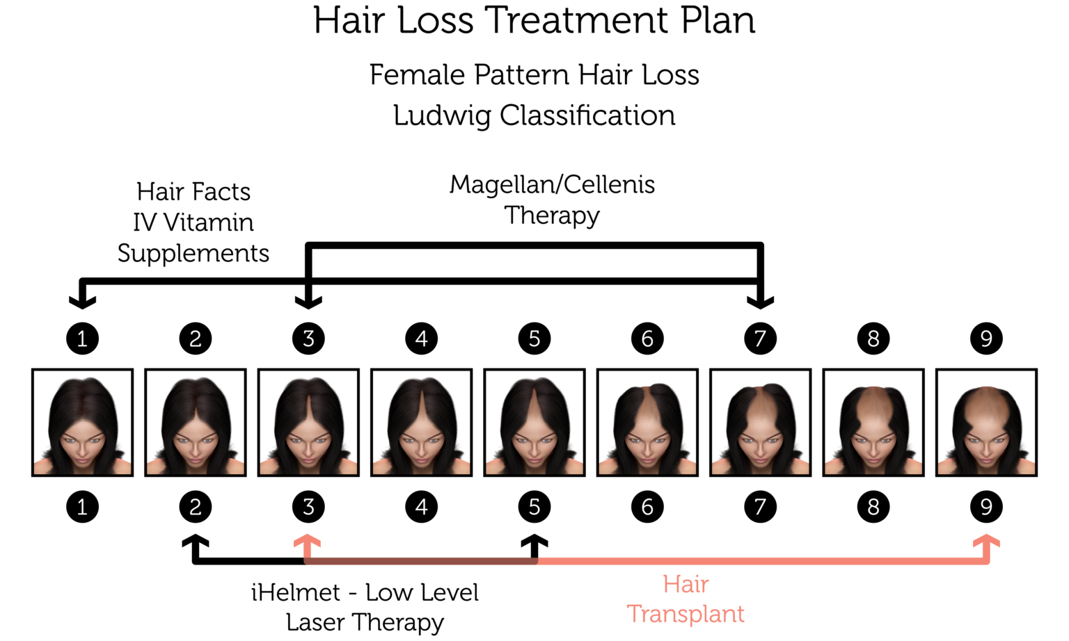 Female Pattern Hair Loss Treatment Rejuvence Clinic 6929