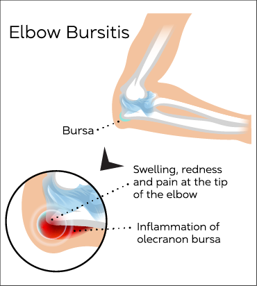 Elbow Anatomy Conditions1