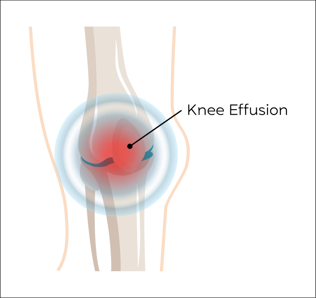 Knee Anatomy Conditions1