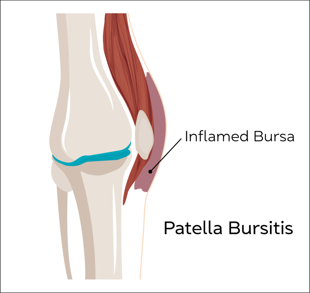 Knee Anatomy Conditions3 1