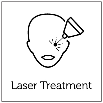 Laser Treatment