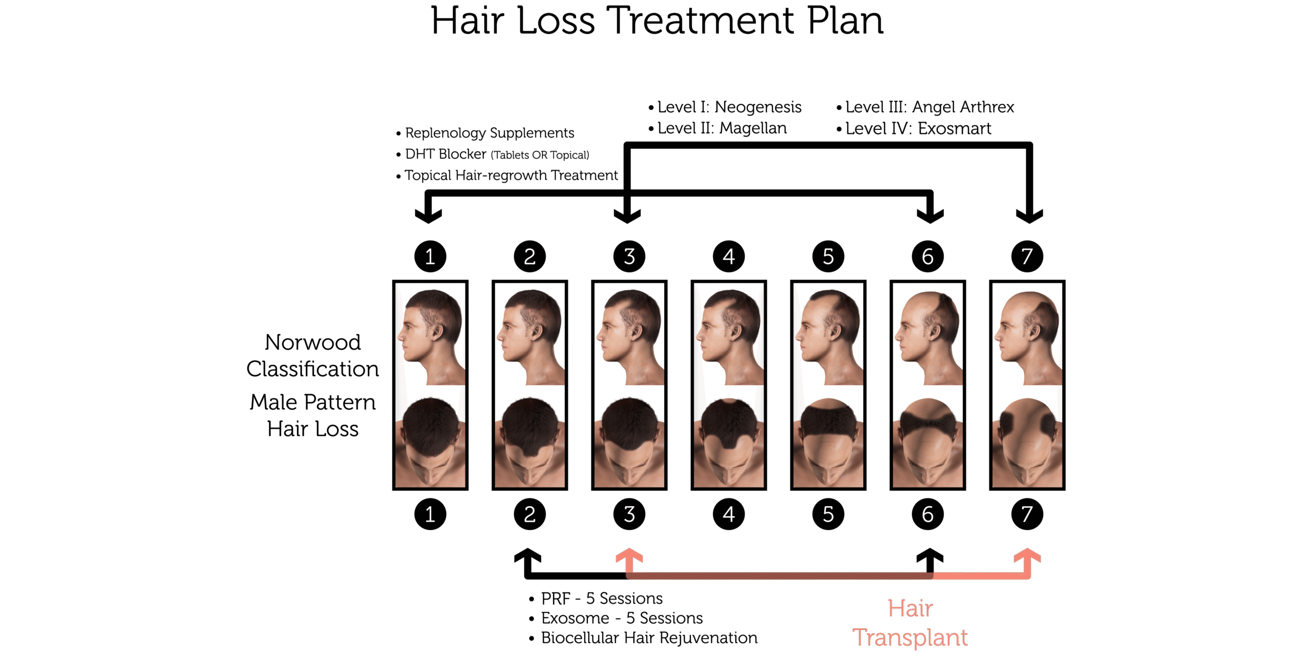 Hair Loss Treatment Plan (Male)