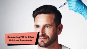 Comparing PRP to Other Hair Loss Treatments