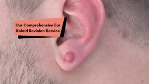 Our Comprehensive Ear Keloid Revision Service