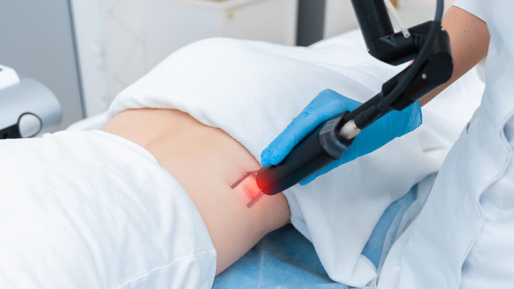 Are Keloids Common in the UK