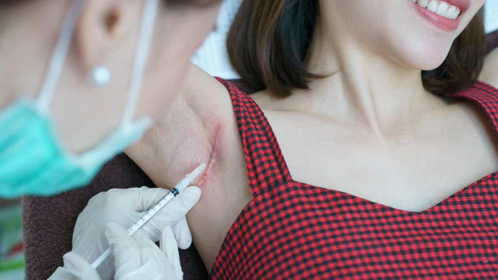 Can the NHS Treat Keloids What UK Patients Should Know