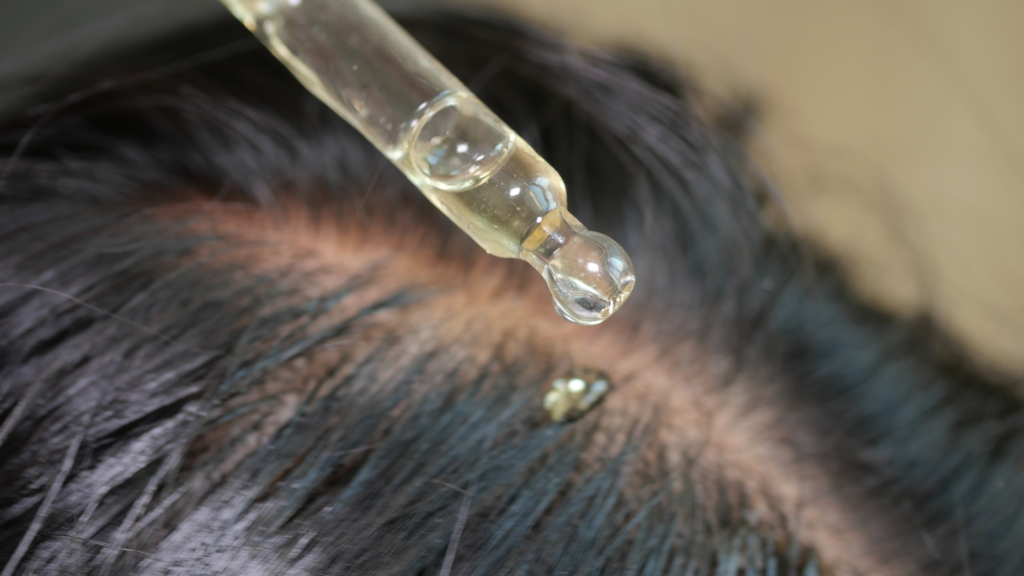 Can PRP Slow Down Progressive Hair Thinning